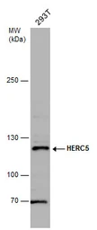 Anti-HERC5 antibody used in Western Blot (WB). GTX130167