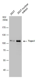 Anti-Topoisomerase I antibody used in Western Blot (WB). GTX130177