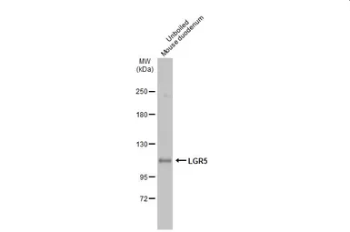 Anti-LGR5 antibody used in Western Blot (WB). GTX130204