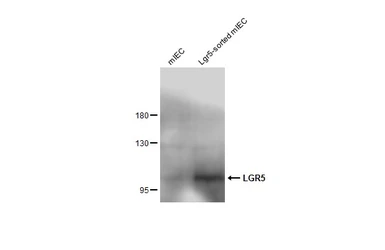 Anti-LGR5 antibody used in Western Blot (WB). GTX130204
