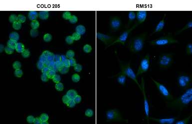 Anti-LGR5 antibody used in Immunocytochemistry/ Immunofluorescence (ICC/IF). GTX130204