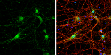 Anti-STX17 antibody used in Immunocytochemistry/ Immunofluorescence (ICC/IF). GTX130212