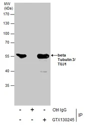 Anti-beta Tubulin 3/ Tuj1 antibody used in Immunoprecipitation (IP). GTX130245
