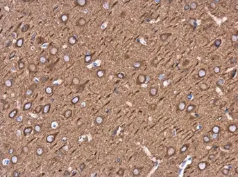 Anti-beta Tubulin 3/ Tuj1 antibody used in IHC (Paraffin sections) (IHC-P). GTX130245