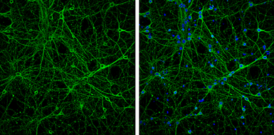 Anti-beta Tubulin 3/ Tuj1 antibody used in Immunocytochemistry/ Immunofluorescence (ICC/IF). GTX130245