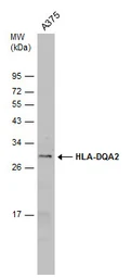 Anti-HLA-DQA2 antibody used in Western Blot (WB). GTX130259