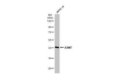 Anti-ASMT antibody used in Western Blot (WB). GTX130292