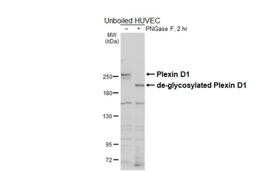 Anti-Plexin D1 antibody used in Western Blot (WB). GTX130372