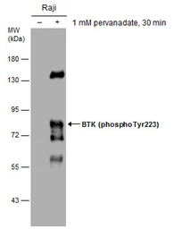 Anti-BTK (phospho Tyr223) antibody used in Western Blot (WB). GTX130377