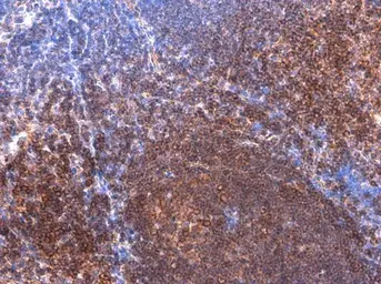 Anti-BTK (phospho Tyr223) antibody used in IHC (Paraffin sections) (IHC-P). GTX130377
