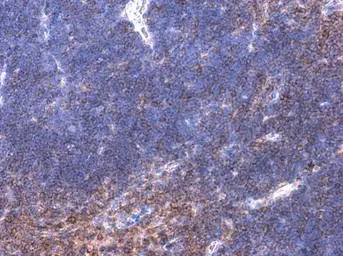 Anti-BTK (phospho Tyr223) antibody used in IHC (Paraffin sections) (IHC-P). GTX130377