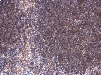 Anti-BTK (phospho Tyr223) antibody used in IHC (Paraffin sections) (IHC-P). GTX130377