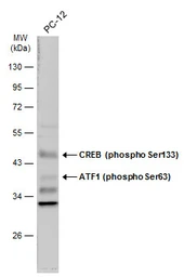 Anti-CREB (phospho Ser133) antibody used in Western Blot (WB). GTX130379