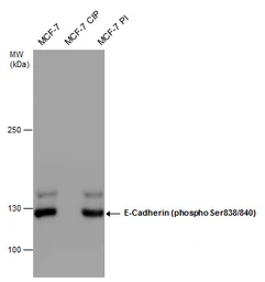 Anti-E-Cadherin (phospho Ser838/840) antibody used in Western Blot (WB). GTX130427