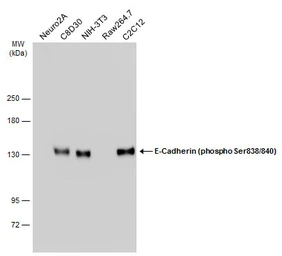 Anti-E-Cadherin (phospho Ser838/840) antibody used in Western Blot (WB). GTX130427