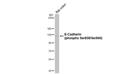Anti-E-Cadherin (phospho Ser838/840) antibody used in Western Blot (WB). GTX130427