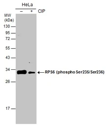 Anti-RPS6 (phospho Ser235/236) antibody used in Western Blot (WB). GTX130430