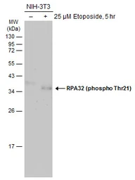 Anti-RPA32 (phospho Thr21) antibody used in Western Blot (WB). GTX130432