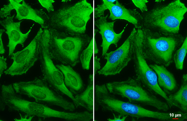 Anti-RPS6 antibody used in Immunocytochemistry/ Immunofluorescence (ICC/IF). GTX130450