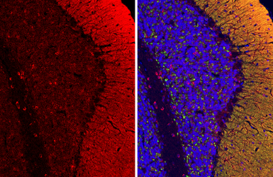 Anti-Tau antibody used in IHC (Paraffin sections) (IHC-P). GTX130462