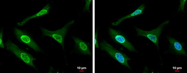 Anti-Gemin 5 antibody used in Immunocytochemistry/ Immunofluorescence (ICC/IF). GTX130498