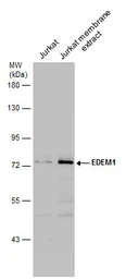 Anti-EDEM1 antibody used in Western Blot (WB). GTX130500