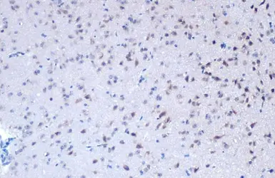 Anti-BRD4 antibody used in IHC (Paraffin sections) (IHC-P). GTX130586