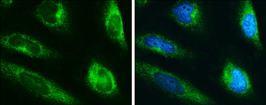 Anti-LYRIC antibody used in Immunocytochemistry/ Immunofluorescence (ICC/IF). GTX130679
