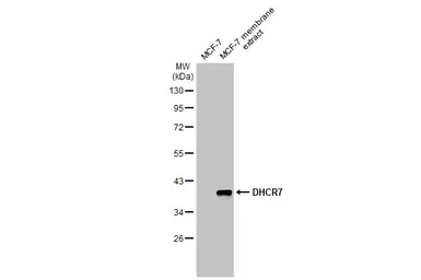 Anti-DHCR7 antibody used in Western Blot (WB). GTX130695