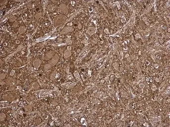 Anti-LKB1 antibody used in IHC (Paraffin sections) (IHC-P). GTX130697