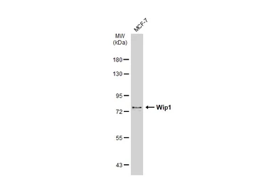 Anti-Wip1 antibody used in Western Blot (WB). GTX130700
