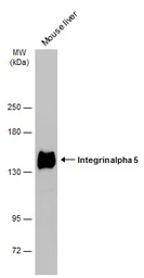 Anti-Integrin alpha 5 antibody used in Western Blot (WB). GTX130705