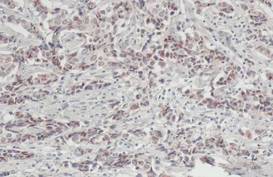 Anti-Jagged 2 antibody used in IHC (Paraffin sections) (IHC-P). GTX130743