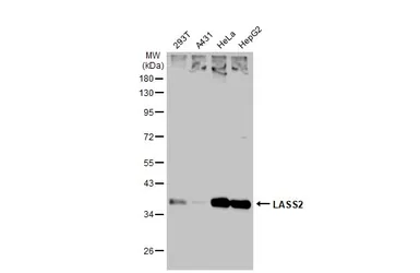 Anti-LASS2 antibody used in Western Blot (WB). GTX130744