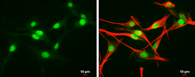 Anti-EDD antibody used in Immunocytochemistry/ Immunofluorescence (ICC/IF). GTX130759