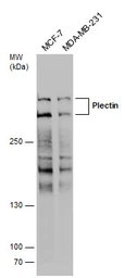 Anti-Plectin antibody used in Western Blot (WB). GTX130764