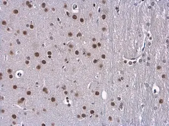 Anti-BTF antibody used in IHC (Paraffin sections) (IHC-P). GTX130772