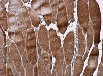 Anti-RAB7A antibody used in IHC (Paraffin sections) (IHC-P). GTX130847