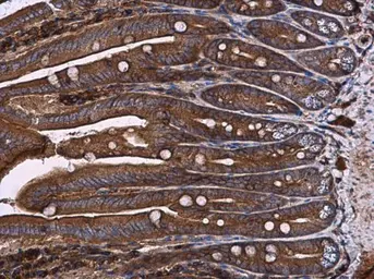 Anti-RAB7A antibody used in IHC (Paraffin sections) (IHC-P). GTX130847