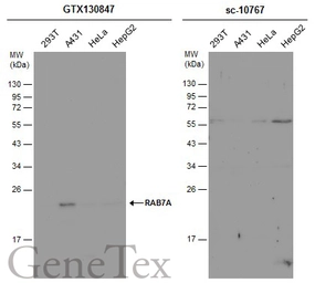 Anti-RAB7A antibody used in Western Blot (WB). GTX130847