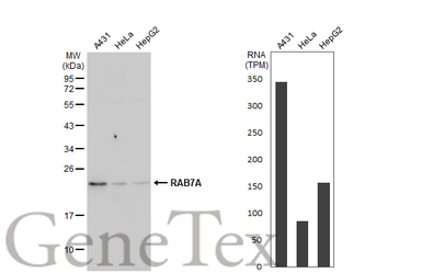 Anti-RAB7A antibody used in Western Blot (WB). GTX130847