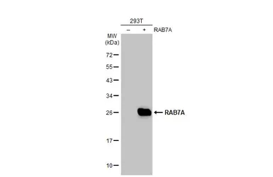 Anti-RAB7A antibody used in Western Blot (WB). GTX130847