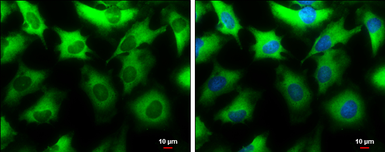 Anti-NMT1 antibody used in Immunocytochemistry/ Immunofluorescence (ICC/IF). GTX130852