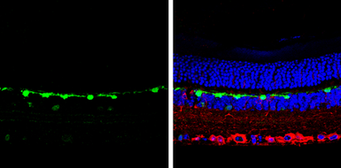 Anti-Calbindin antibody used in IHC (Paraffin sections) (IHC-P). GTX130856