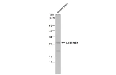 Anti-Calbindin antibody used in Western Blot (WB). GTX130856