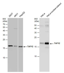 Anti-TAF12 antibody used in Western Blot (WB). GTX130863