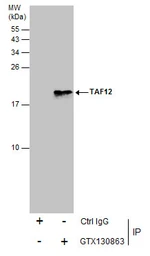 Anti-TAF12 antibody used in Immunoprecipitation (IP). GTX130863
