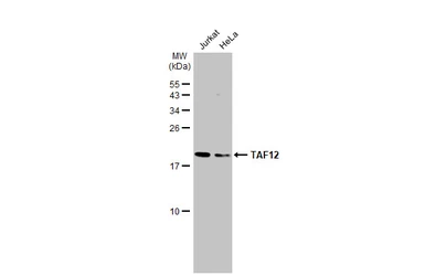Anti-TAF12 antibody used in Western Blot (WB). GTX130863