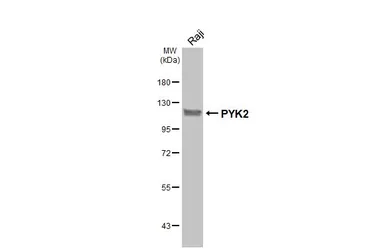 Anti-PYK2 antibody used in Western Blot (WB). GTX130887