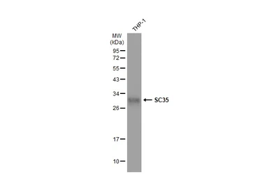 Anti-SC35 antibody used in Western Blot (WB). GTX130950